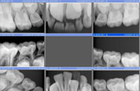 radiografias